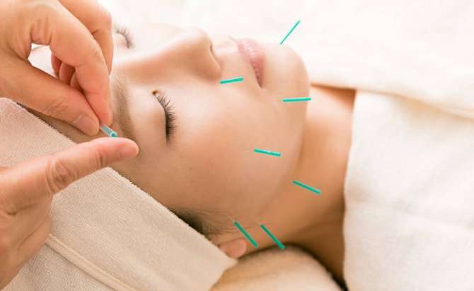 くすみ・くま撃退！美容鍼で叶える若見えフェイスケア